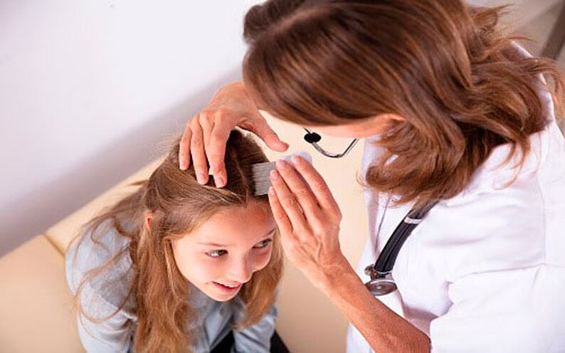 trattamento della psoriasi della testa nei bambini