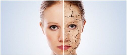 Trattiamo la psoriasi